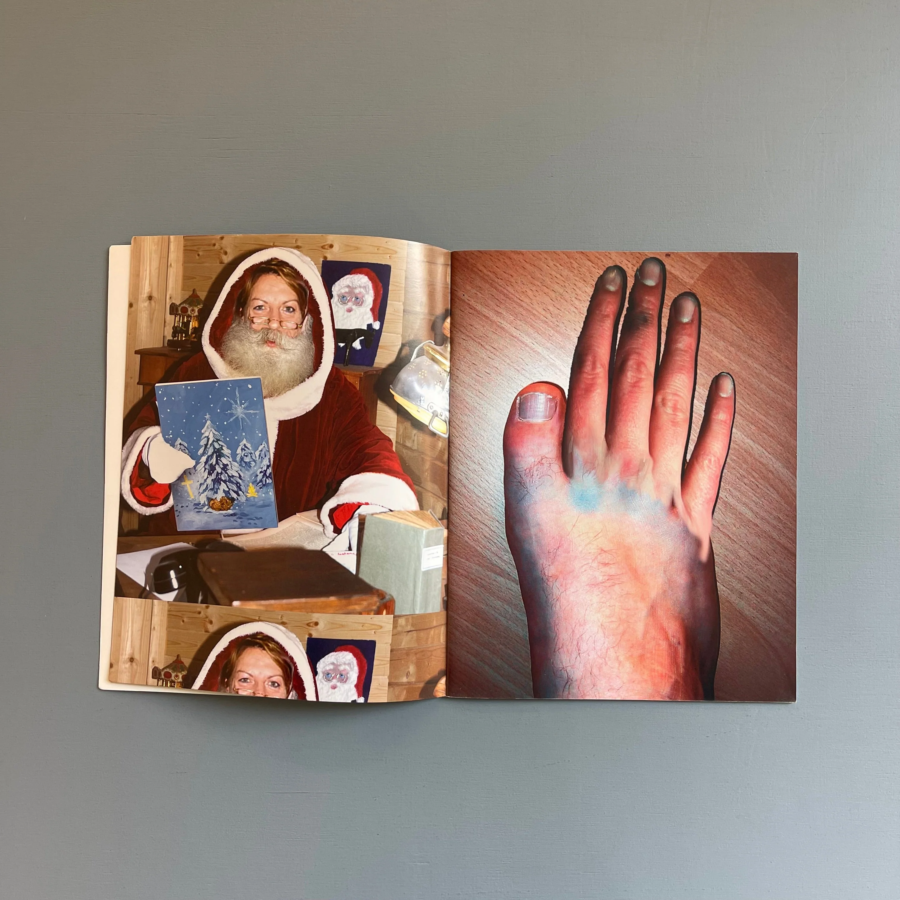 Thumb 3